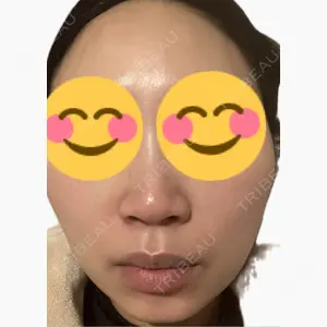 吉祥寺アイビークリニック口コミ