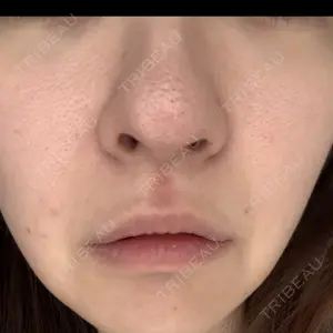 DAILY SKIN CLINIC 新宿院口コミ