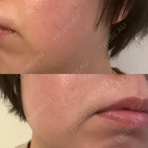 おおたかの森ビューティークリニック口コミ