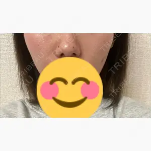 TCB東京中央美容外科 つくば院口コミ
