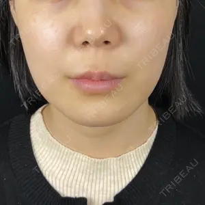 藤・ナチュレ美容クリニック 銀座院口コミ