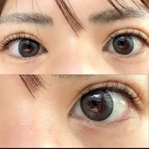 PRO CLINIC プロクリニック 銀座院口コミ