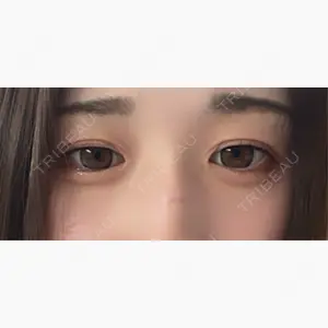 共立美容外科 浜松院口コミ