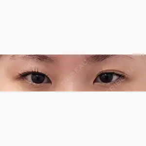 IK美容整形外科口コミ