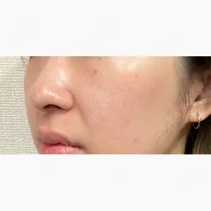 Chloe Cheongdam Clinic （クロエチョンダムクリニック）口コミ