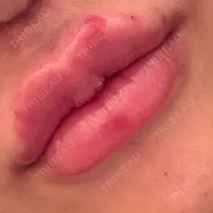 ルラ美容クリニック 渋谷本院口コミ