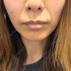 ルラ美容クリニック 岡山院口コミ