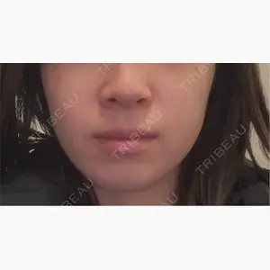 PRO CLINIC プロクリニック 銀座院口コミ
