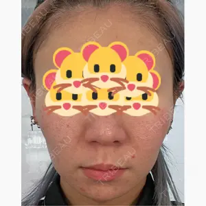 ルラ美容クリニック 上野院口コミ