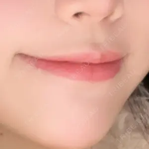 ECLA CLINIC (エクラクリニック)口コミ