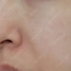 ルラ美容クリニック 宇都宮院口コミ