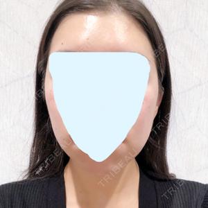 Zetith Beauty Clinic 銀座院口コミ
