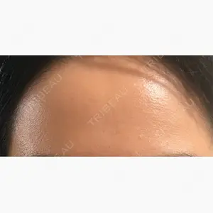 湘南美容クリニック 渋谷院口コミ