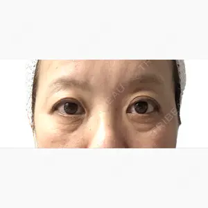 アリエル美容クリニック 大宮院口コミ