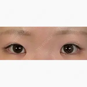 アリエル美容クリニック 大宮院口コミ