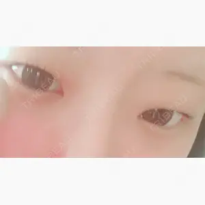 アリエル美容クリニック 郡山院口コミ