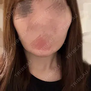 セギム美容整形外科口コミ