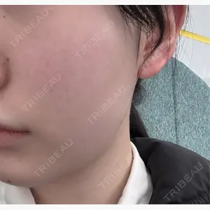 HAAB CLINIC 池袋院口コミ