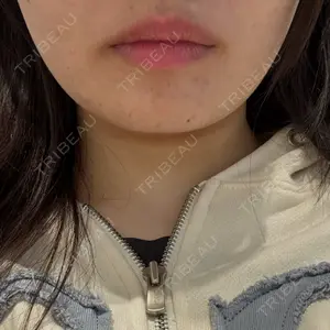 Tokyo Tensei Clinic 大阪梅田院口コミ