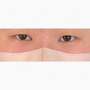 アリエル美容クリニック 大宮院口コミ