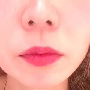 ルラ美容クリニック 岐阜院口コミ