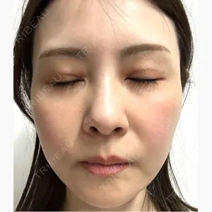 けやき美容クリニック 沼津院口コミ