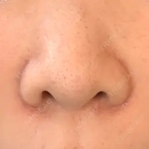 聖心美容クリニック 六本木院口コミ
