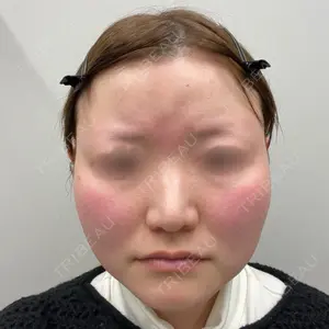 小倉美容外科ネビュラクリニック口コミ