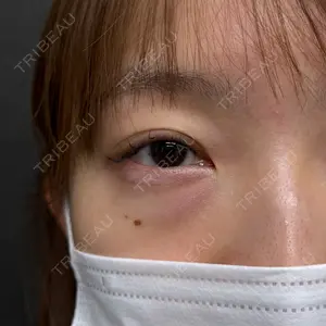 ネビュラクリニック 京都院口コミ