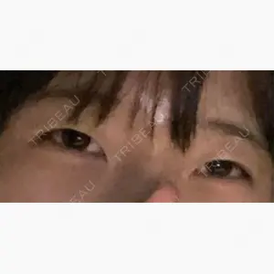 ルラ美容クリニック 渋谷本院口コミ