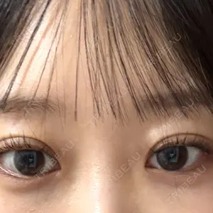 渋谷あおぞらクリニック美容外科・美容皮膚科口コミ