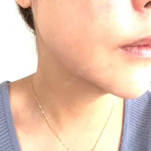 REDLINE CLINIC口コミ