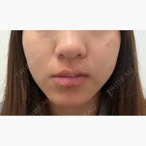 ルラ美容クリニック 京都院口コミ
