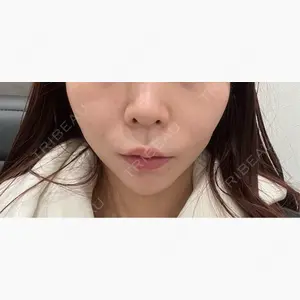 東京美容外科 名古屋院口コミ