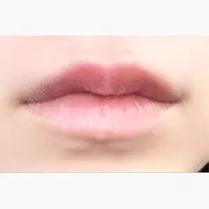 ルラ美容クリニック 仙台院 / ルラスキンクリニック 仙台院口コミ