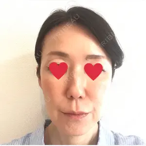 ゆきスキンクリニック 東池袋口コミ
