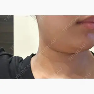 名古屋美容外科口コミ