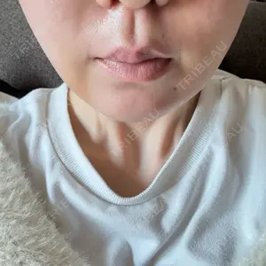 札幌美容外科ネビュラクリニック口コミ