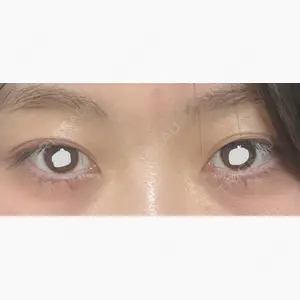 フィラークリニック 新宿院口コミ