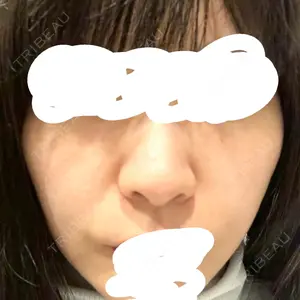 TCB東京中央美容外科 佐賀院口コミ