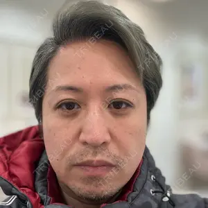 エースクリニック 大阪梅田HEPナビオ院口コミ
