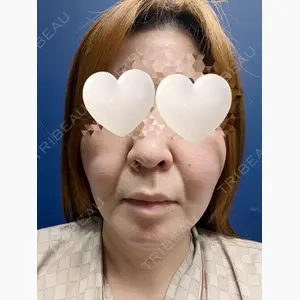 アムルーズ美容外科クリニック 大阪院口コミ