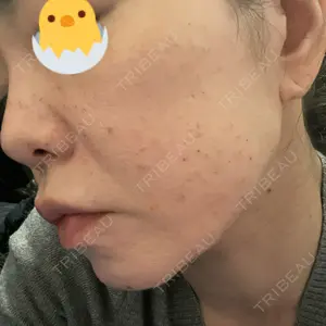 ゆきスキンクリニック 東池袋口コミ