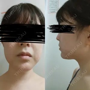 脂肪吸引の森クリニック東京院口コミ