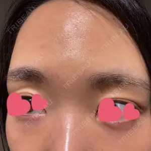 聖心美容クリニック 大宮院口コミ