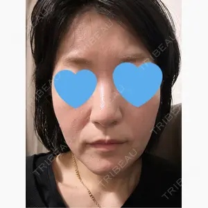 おおかみ美容のクリニック 新宿院口コミ