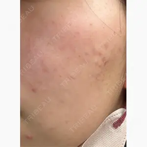 ルラ美容クリニック 札幌本院口コミ