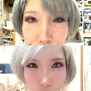 HAAB×DREAM BEAUTY CLINIC 東京本院口コミ
