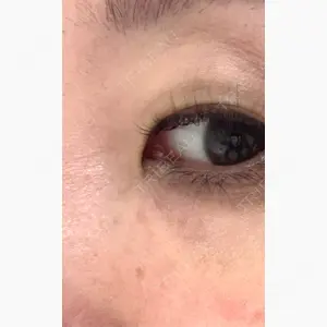 美容皮膚科エルムクリニック 岡山院口コミ