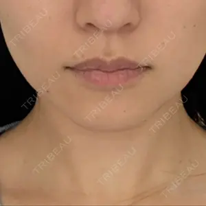 LUNAGE CLINIC（ルナージュクリニック）口コミ